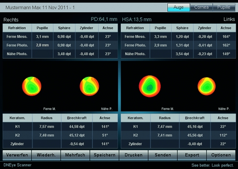 2014/DNEye%20Scanner/DNEye4.jpg